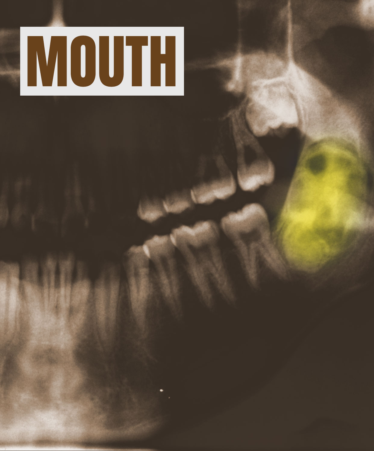 Mouth